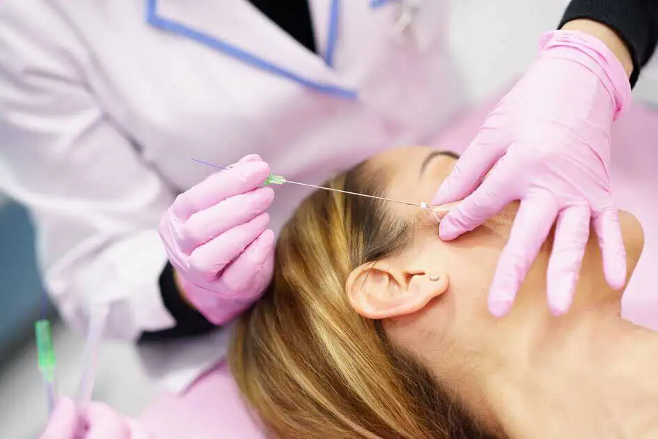 PDO Thread Lift by Bellava Aesthetics in Crestview Hills KY